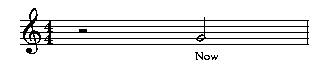 Picture of Mup output